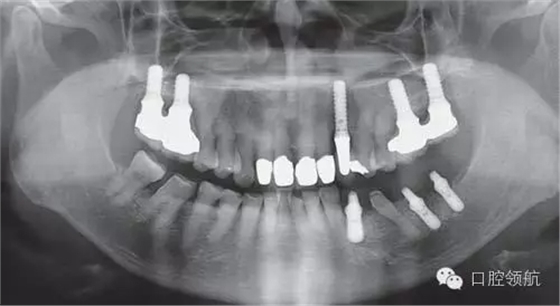 2.webp.jpg 2.webp.jpg