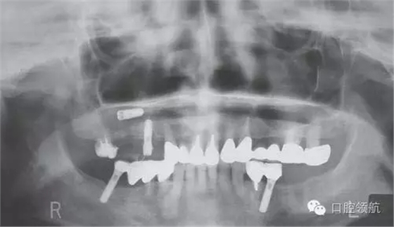 640.webp (1).jpg 640.webp (1).jpg