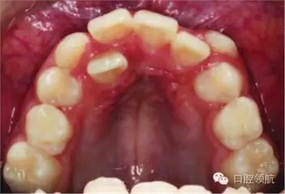 640.webp (5).jpg 640.webp (5).jpg