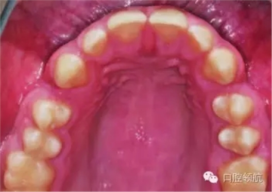 640.webp (6).jpg 640.webp (6).jpg