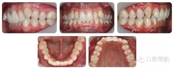 640.webp (8).jpg 640.webp (8).jpg