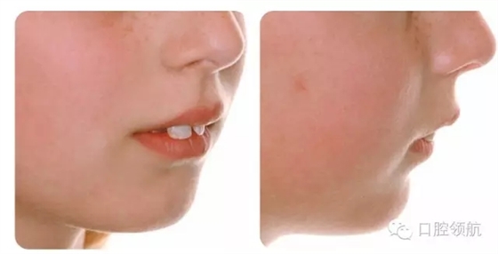 640.webp (9).jpg 640.webp (9).jpg