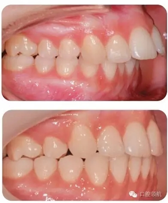 640.webp (10).jpg 640.webp (10).jpg