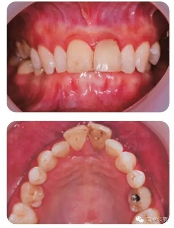 640.webp (11).jpg 640.webp (11).jpg