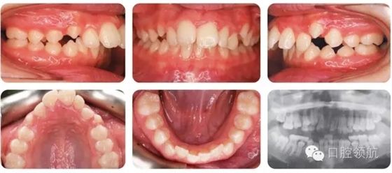 1.webp.jpg 1.webp.jpg