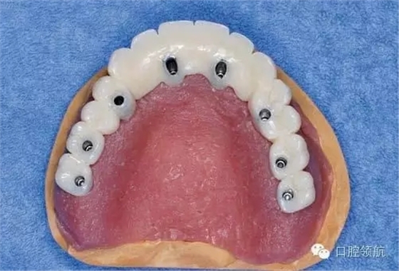 640.webp (3).jpg 640.webp (3).jpg