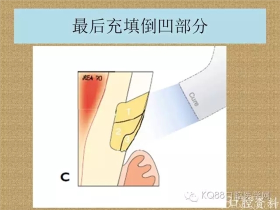 640.webp (17).jpg 640.webp (17).jpg