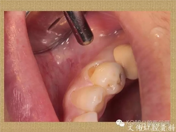 640.webp (37).jpg 640.webp (37).jpg