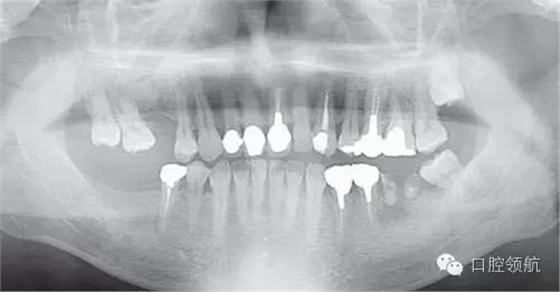 640.webp (1).jpg 640.webp (1).jpg