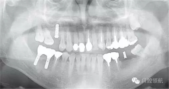 640.webp (2).jpg 640.webp (2).jpg