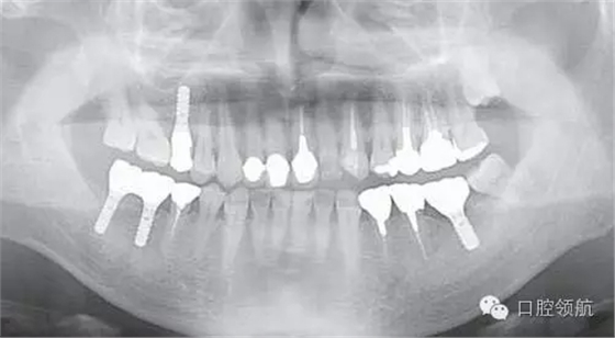 640.webp (9).jpg 640.webp (9).jpg