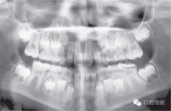 640.webp.jpg 640.webp.jpg