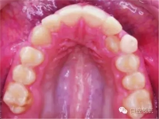 640.webp (2).jpg 640.webp (2).jpg