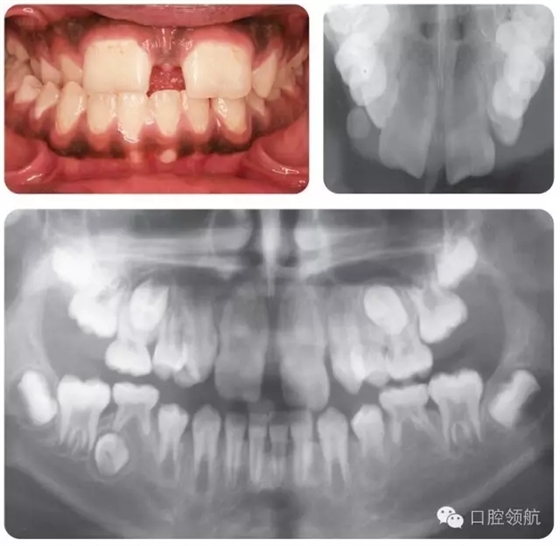 640.webp (4).jpg 640.webp (4).jpg