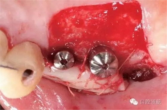 640.webp (4).jpg 640.webp (4).jpg