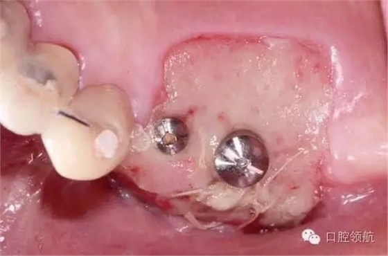 640.webp (5).jpg 640.webp (5).jpg