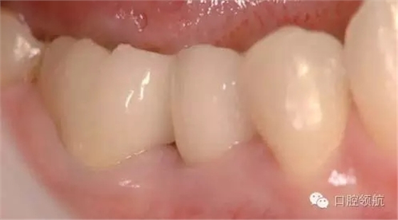 640.webp (1).jpg 640.webp (1).jpg