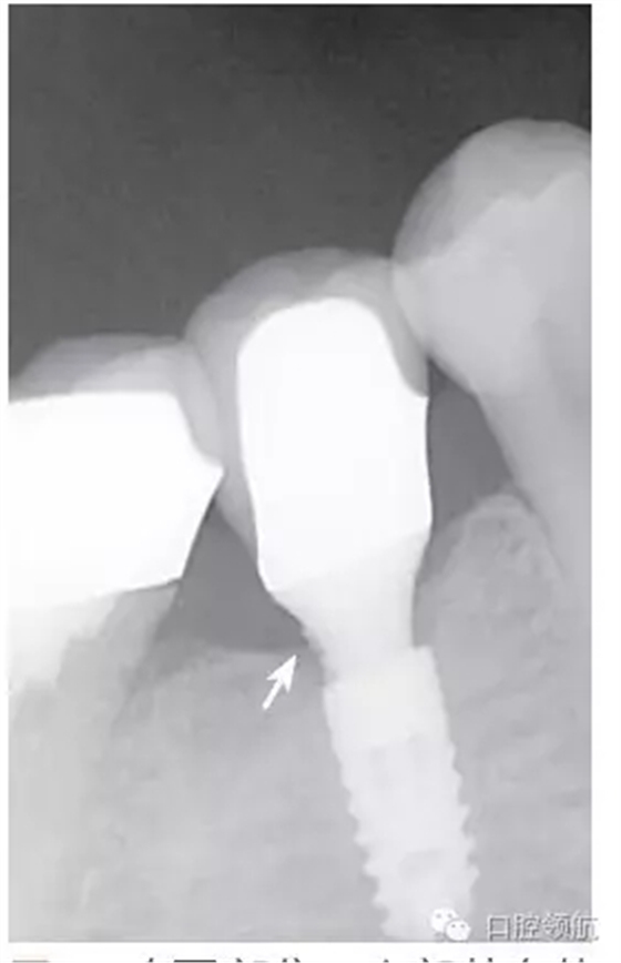 640.webp (2).jpg 640.webp (2).jpg