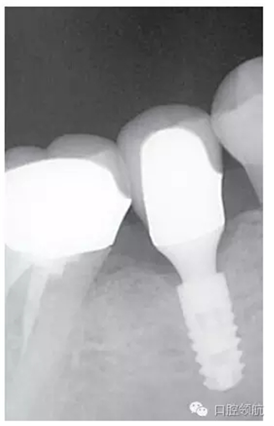 640.webp (3).jpg 640.webp (3).jpg