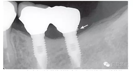 640.webp (4).jpg 640.webp (4).jpg