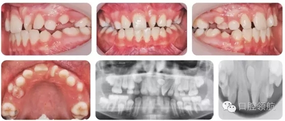 30.webp.jpg 30.webp.jpg