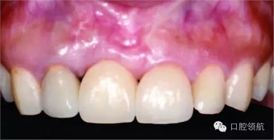 640.webp (9).jpg 640.webp (9).jpg