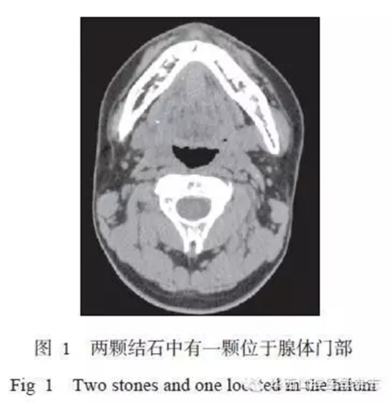 640.webp.jpg 640.webp.jpg