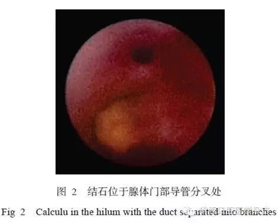 640.webp (1).jpg 640.webp (1).jpg