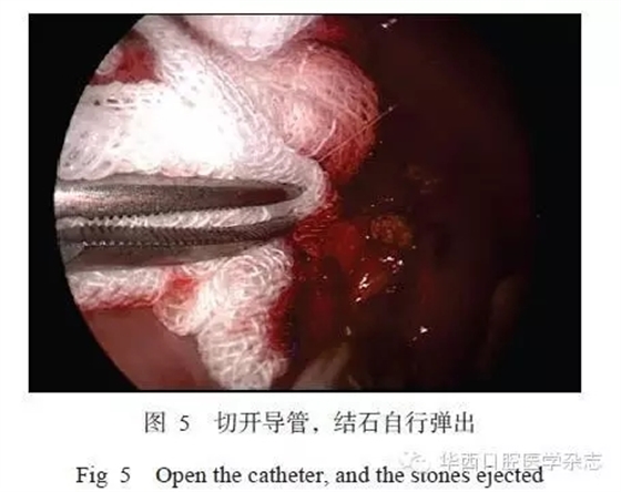 640.webp (4).jpg 640.webp (4).jpg