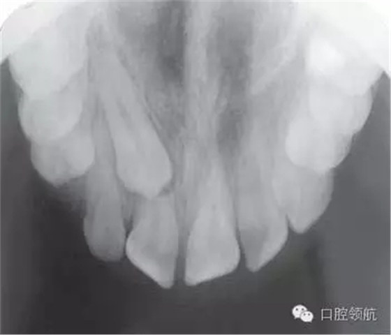 640.webp (1).jpg 640.webp (1).jpg