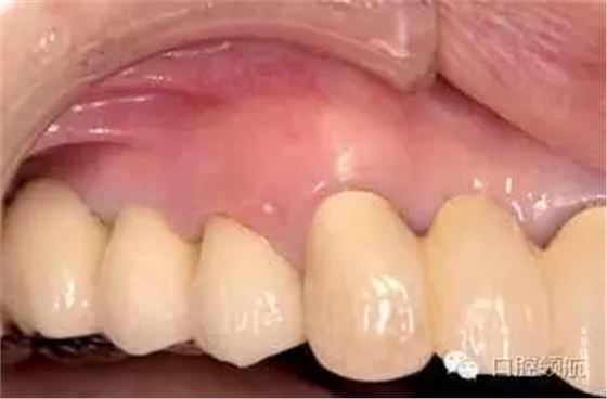 640.webp (1).jpg 640.webp (1).jpg