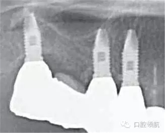 640.webp (2).jpg 640.webp (2).jpg