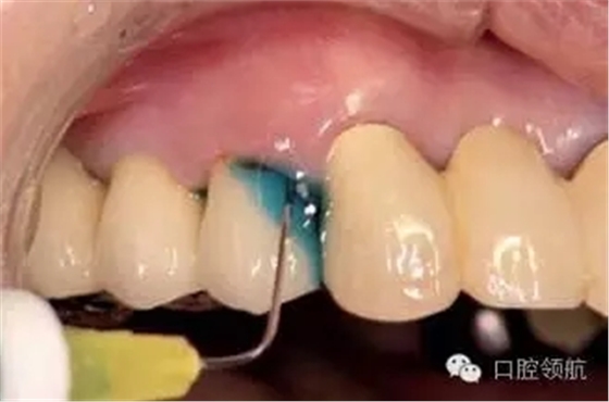 640.webp (3).jpg 640.webp (3).jpg