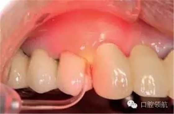 640.webp (4).jpg 640.webp (4).jpg