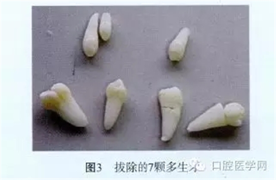 640.webp (2).jpg 640.webp (2).jpg