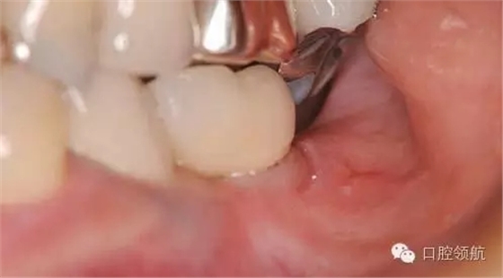 640.webp (1).jpg 640.webp (1).jpg