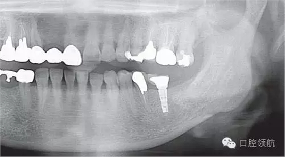 640.webp (2).jpg 640.webp (2).jpg