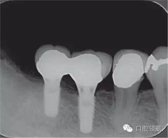 640.webp (2).jpg 640.webp (2).jpg