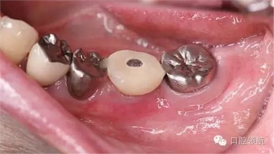 640.webp (1).jpg 640.webp (1).jpg