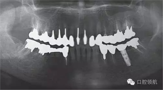 640.webp (2).jpg 640.webp (2).jpg