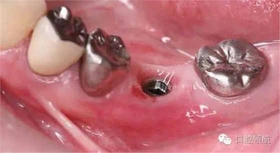 640.webp (6).jpg 640.webp (6).jpg