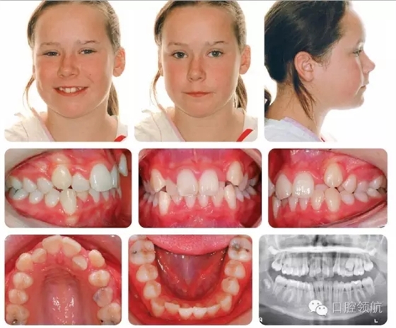 640.webp (2).jpg 640.webp (2).jpg