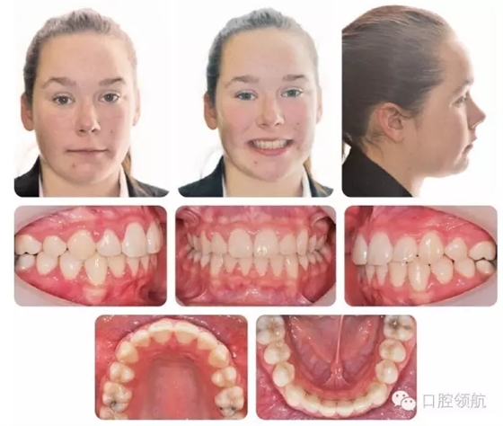 640.webp (4).jpg 640.webp (4).jpg