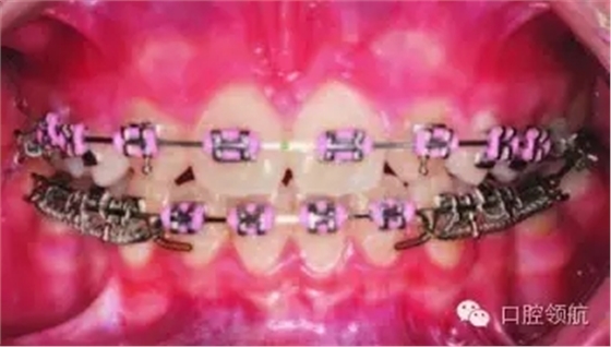 640.webp (7).jpg 640.webp (7).jpg