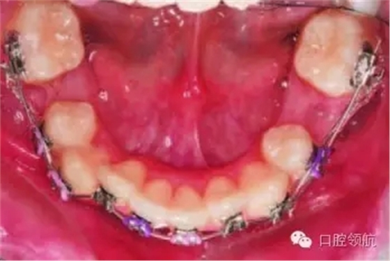 640.webp (8).jpg 640.webp (8).jpg