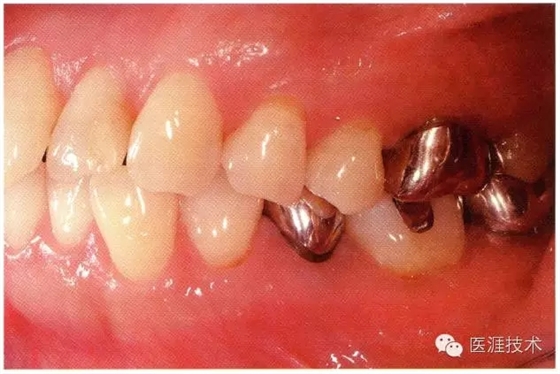 640.webp (3).jpg 640.webp (3).jpg