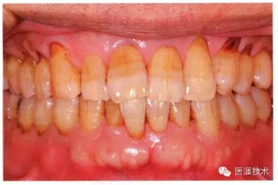 640.webp (7).jpg 640.webp (7).jpg