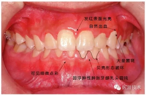 640.webp (10).jpg 640.webp (10).jpg