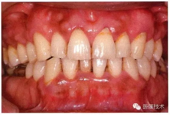 640.webp (16).jpg 640.webp (16).jpg