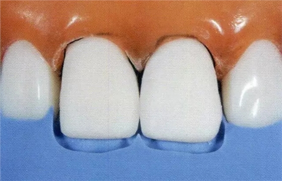 640.webp (5).jpg 640.webp (5).jpg